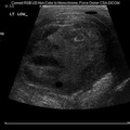 وجه بشري في صورة أشعة